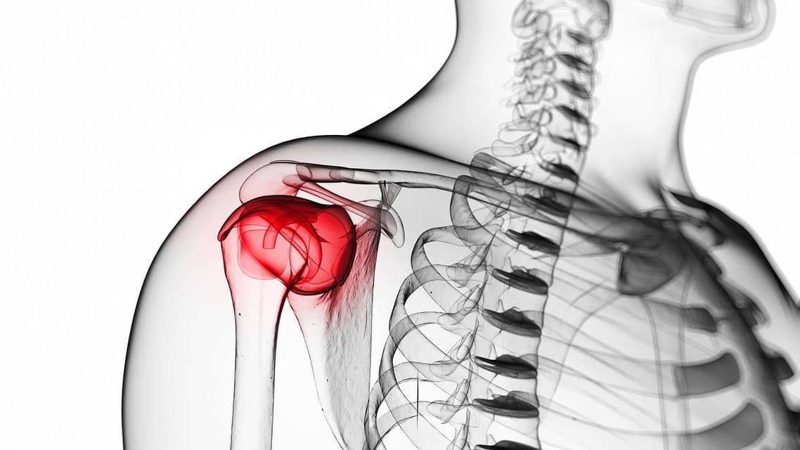 Physiotherapy for Rotator Cuff Tendinopathy